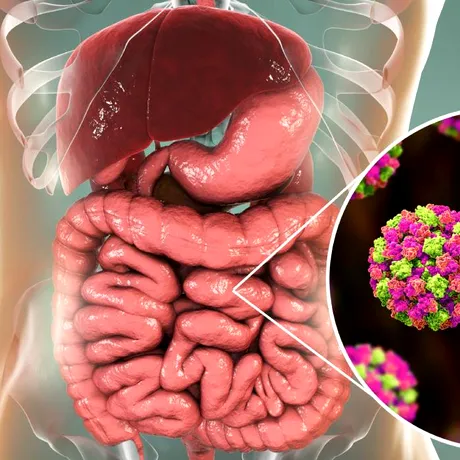 6 simptome care apar când ești infectat cu un virus „extrem de contagios”. Nu ieși din casă dacă le ai