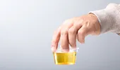 Ce spune culoarea urinei despre sănătatea ta