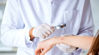 Ectima: de ce apare și cum o tratezi