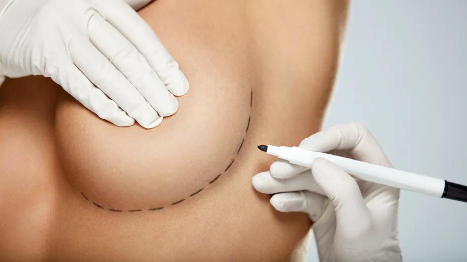 Implanturile mamare pot afecta alăptarea: adevăr sau minciună?