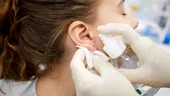 3 pași simpli pentru îngrijirea și vindecarea după un piercing în ureche