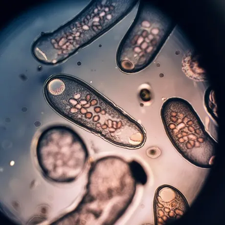 Cum să faci o curățare eficientă a paraziților intestinali