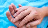 Un semn discret la vârful degetelor poate avertiza asupra unor boli pulmonare grave. Medicii explică ce trebuie să observi