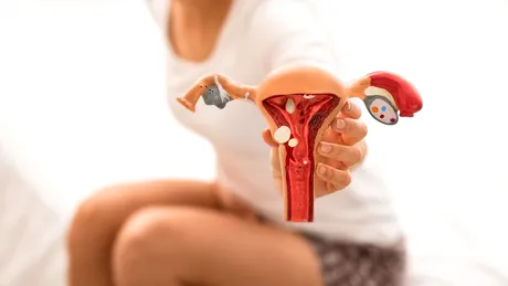 13 mituri despre chisturile ovariene. E adevărat că trebuie mereu operate sau că apar mai rar la femeile care fac copii?