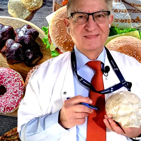 Care este cel mai periculos aliment pentru creier, potrivit medicului Vlad Ciurea: „Este toxic pentru celula nervoasă”