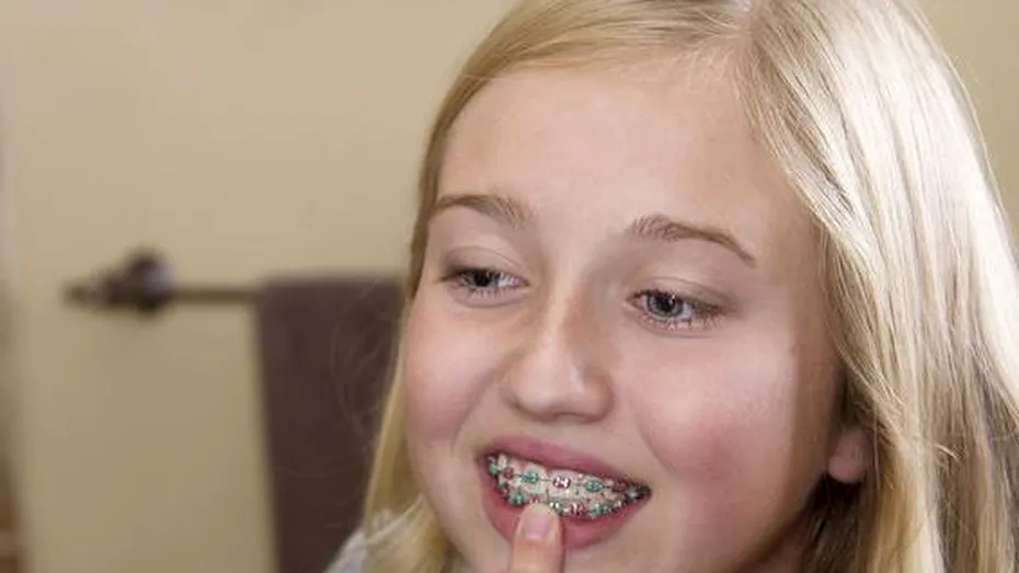 Top 10 lucruri pe care trebuie să le ştie un părinte înainte de a-i pune copilului aparat dentar