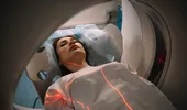 Cum poți face un RMN în siguranță dacă ai un dispozitiv implantabil de tip stent sau stimulator cardiac