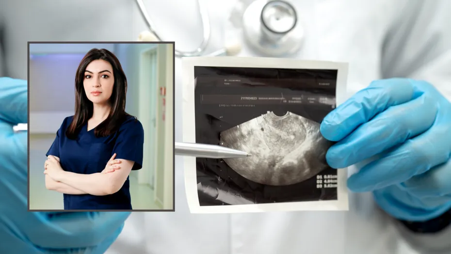 De ce ecografia nu este suficientă în endometrioza profundă și de ce RMN-ul schimbă planificarea intervenției