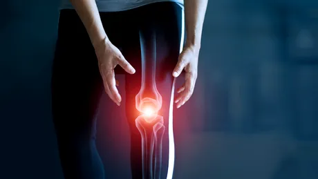 Gonartroza genunchiului de la A la Z | Dr. Mihai Râșcu: “Oricine poate deveni protagonistul acestei povești odată cu înaintarea în vârstă”