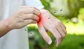 Plantele care te scapă de țânțari. Sunt mai bune decât orice spray