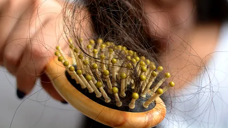 Cum tratezi părul mixt: scalp gras și vârfuri uscate sau scalp cu mătreață și vârfuri uscate?