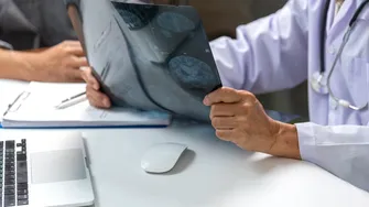 O tânără a trăit doi ani cu o tumoră cerebrală. Cum a fost interpretată greșit boala?