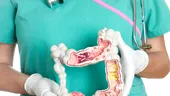 Cancerul intestinului gros, a doua cea mai frecventă formă de cancer în România