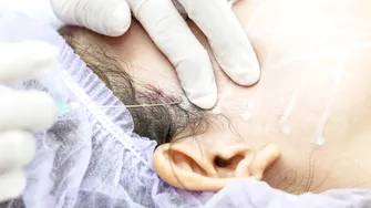 Colegiul Medicilor investighează medicul estetician din București, după ce o pacientă venită pentru lifting a ajuns în comă și a murit / VIDEO