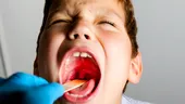 Copilul are episoade dese de „roșu în gât”? Rapid la medicul ORL, poate avea amigdalele inflamate!