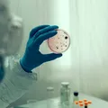 Ebola are nevoie de un răspuns rapid pentru a evita o catastrofă