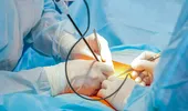 Dr. gastroenterolog Bianca Istratie: Complicaţiile postoperatorii ale stomacului