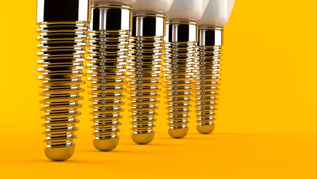 Dr. Claudiu Lupascu, specialist implantologie: beneficiile implantului dentar