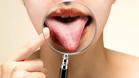 De ce simți gust metalic în gură și când ar trebui să te îngrijorezi