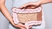 Test de 1 minut pentru sănătatea intestinală! Cât de sănătos e colonul tău