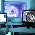 Cum recunoaștem un AVC și cum trebuie să acționăm
