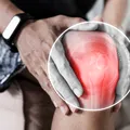 5 plante care pot completa efectele giloy în cazul durerilor articulare și al inflamației