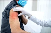 Efectele vaccinului COVID pe termen lung – sunt motive de îngrijorare?