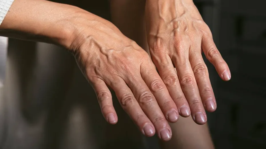 Corpul nu îmbătrânește treptat, ci în „salturi”. Vârstele la care apar cele mai importante schimbări