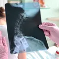 Postura copilului tău nu se îndreaptă singură. Ce ar trebui să știe orice părinte despre coloana vertebrală a copilului său