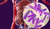 Ce se întâmplă dacă mănânci multe dulciuri când iei antibiotice. Cum are de suferit, de fapt, microbiomul