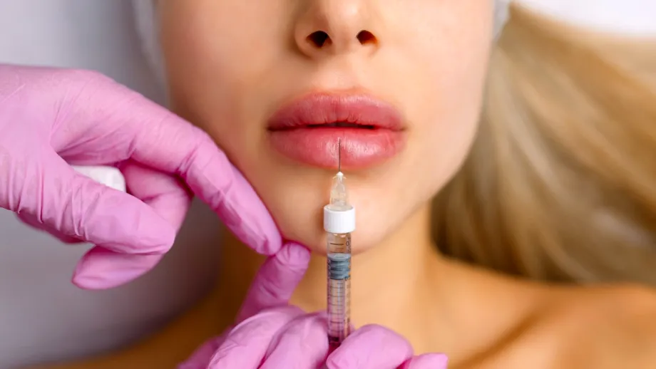 4 adevăruri surprinzătoare despre injecțiile în buze. Numărul 3 te va șoca