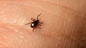 Cum recunoști o căpușă și când trebuie scoasă de medic