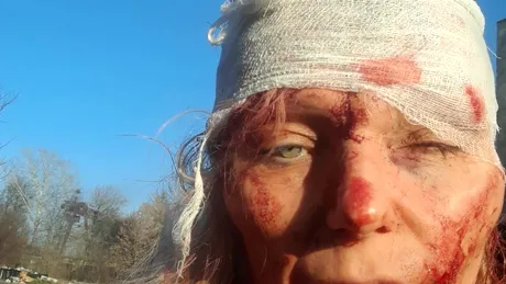 Olena Kurilo, femeia devenită imaginea-simbol a războiului dintre Rusia și Ucraina, în urma unui bombardament