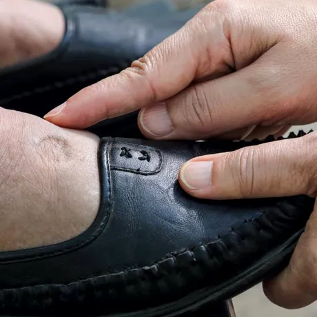 Ai picioare umflate? Boli grave care pot fi semnalate de aces simptom. Nu e de la consumul excesiv de sare și nici de la încălțăminte!