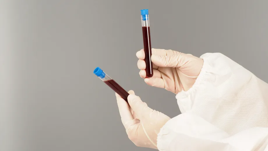 Cum să reduci trigliceridele prin dietă. Alimentul la care trebuie să renunți