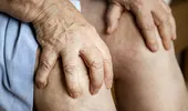 Durerea de genunchi: de ce apare și cum poți scăpa de ea prin mișcare