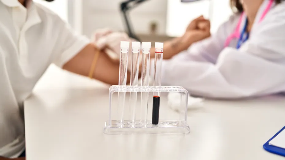 Poate o simplă analiză de sânge să arate cancerul? Ce trebuie să știi despre hemogramă