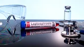 Leptospiroza: boala bacteriană care poate apărea după contactul cu apă contaminată. Cum se transmite, ce simptome are și cum poate fi prevenită