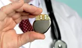 Ce este un stimulator cardiac și care sunt semnele că ai nevoie de un astfel de dispozitiv. 10 întrebări și răspunsuri despre pacemaker