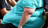 Diagnosticul de obezitate înainte de 30 de ani crește riscul de moarte prematură cu 70%