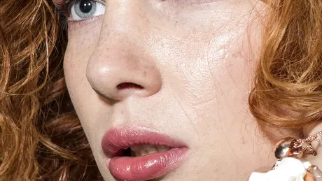 4 factori de risc pentru cancerul de piele la care nu te-ai fi gândit