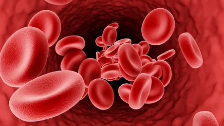 Ateroscleroza, mai răspândită în Europa de Est: interviu cu un expert (II)