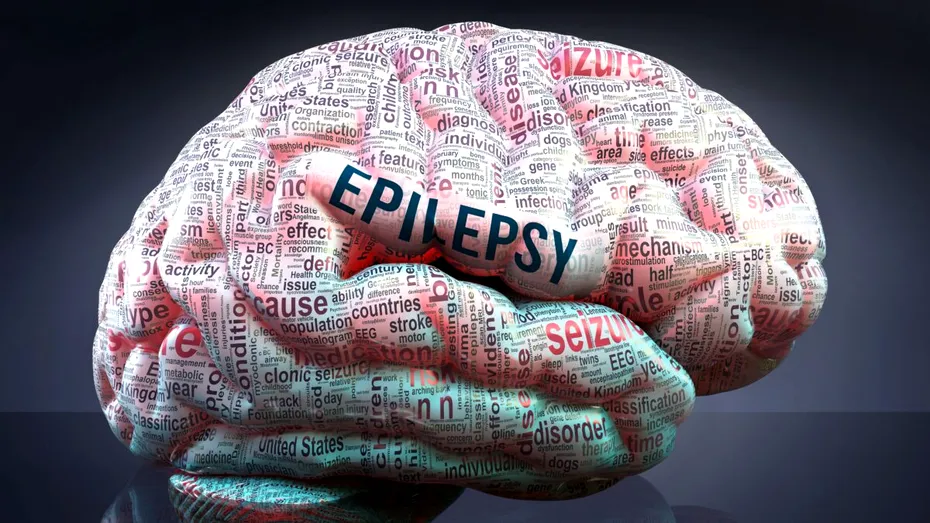 Noutăți în tratamentul epilepsiei: medicamente, opțiuni chirurgicale, stimularea nervului vag, terapia genică