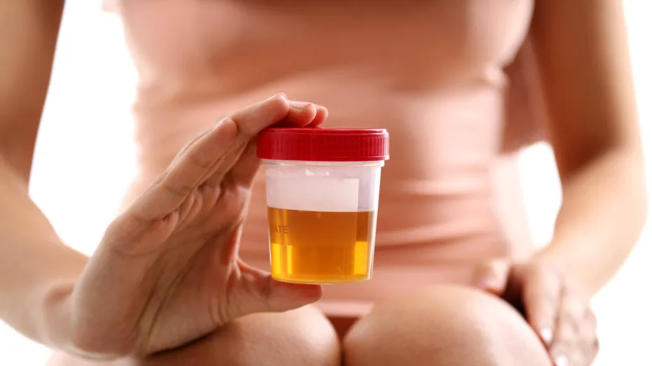 Ce îți spune culoarea urinei despre sănătatea ta. Semnale pe care nu trebuie să le ignori