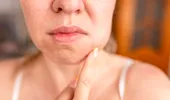 Ce se întâmplă cu dinții și gingiile în timpul menopauzei. Explicațiile medicului stomatolog