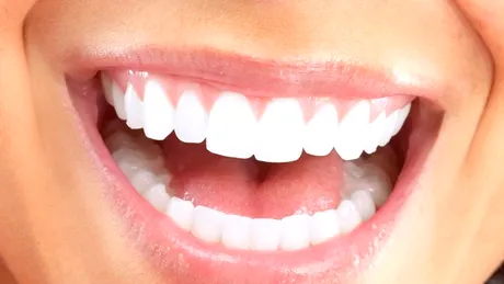 Dinţi albi – cum îi poţi avea?