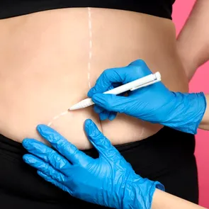 Prima vară după chirurgia bariatrică: cum îți schimbi corpul, dar și relația cu tine însuți