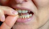 Condimentul pe care e bine să-l mesteci în fiecare zi. Vei fi uimit ce vei elimina din organism