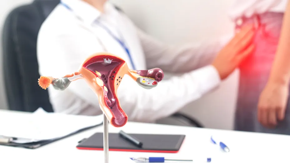 Cât de mari pot crește fibroamele uterine? Explică dr. Ștefan Tucă