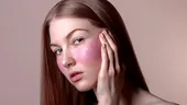 De ce nu dispar acneea și eczema? Medicul spune că răspunsul ar putea fi în intestin